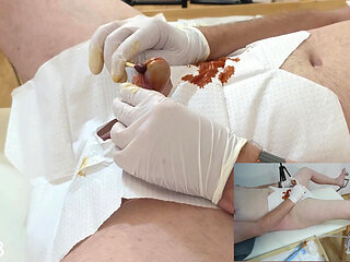 18 French Foley Catheter Insertion
