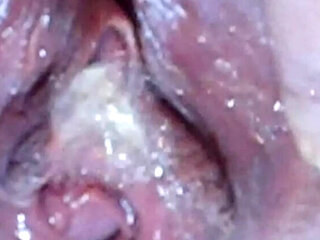 Close Up Pissing Compilation 2 - Deep Keely's Bald Pussy Spread Wide Open