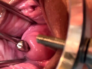 Exploring My Cervix With Sound And Fingers
