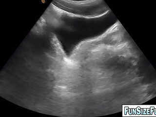 ULTRA SCAN revealed a HUGE Secret Hidden in His Belly! Grayson Cole examination of his colon by Legrand Wolf turned out to be an experience he would never forget!