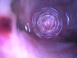 Fiberscope in urethral test tube