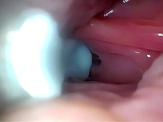 Semen in Cervix Wide Stretching Pussy Endoscope!