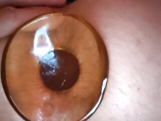 My gaping hole