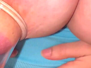 Nipple Cupping Part 2