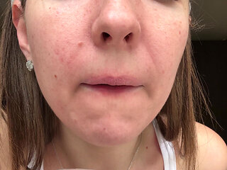 Morning Saliva,phlegm