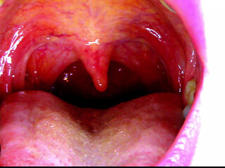 Sexy Scarlet Says Ahhhh - Uvula Showoff