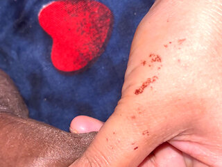 Rubbing in All Right Places