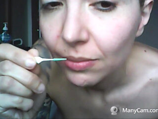 Chantal's Teeth Fall Apart, Rotten and Black