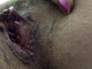 My Hairy Pussy After Birth