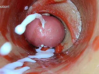 Camera Inside Deep Pussy Captures Dose Ejaculation of Sperm ASMR