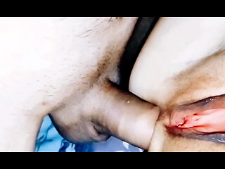 Close up anal with open pussy lips