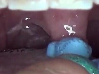 Swallowing and Playing with Big Plastic Bears