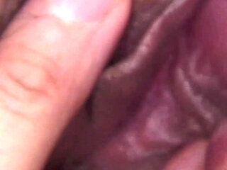 Even if He Has a Broken Arm, This Lucky Man Knows How to Properly a Nurse.