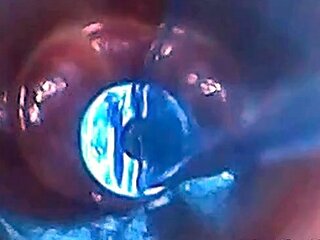 Endoscope POV: Test Tube Cock Urethral Insertion