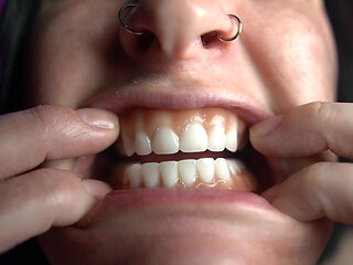 Mouth Tour with Dentures in