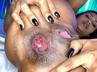 flexi skinny milf prolapse her anus for rough fucking