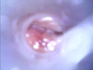 View Inside Cock While Jerking and Cumshot ( Camera Inside Dick )