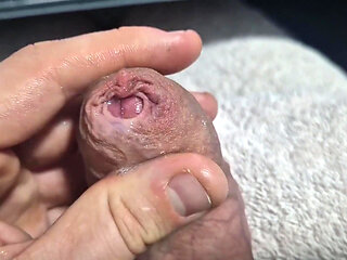 Uncut Tight Phimosis Cock Foreskin Stretched Close up