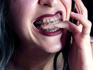 Biting my own fingers - bite, mouth, teeth, braces, fetish ITA