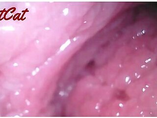 Endoscopic Vaginal Observation