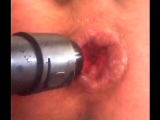 my big anal lips get sucked in by a vacuum cleaner while i jerkoff my prolapse