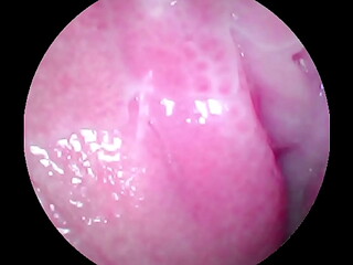 Camera deep inside of the wet pussy and captured the intense female orgasm!!