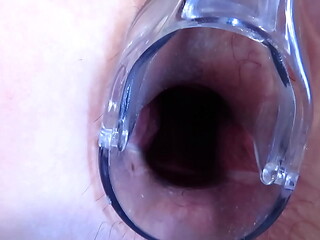 Stretching the anal and vagina with a gynecological speculum. MILF with a big butt and a gaping asshole and a gaping pussy.
