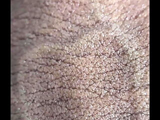 O QUE S&Atilde_O ESSAS MANCHAS EM MEU PENIS? UM CLOSE BEM DE PERTO