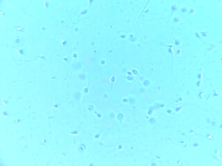Fresh Cum Under Microscope! My Sperm Swimming Wildly - Super Clear View