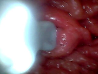 First time: An endoscope reveals the G-spot up close &ndash_ without mounting!