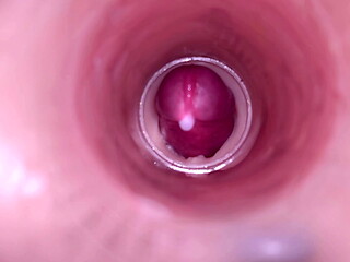 Female Insemination - Internal Camera Captures Deep Male Ejaculation