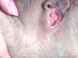 Prolapse Play Close up