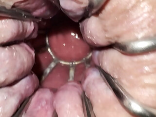 Reneenicolecd - update #30 - Gape anal stretch cage - Apr 19, 2026