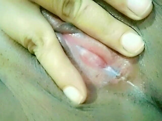 White discharge from vagina pussy hole