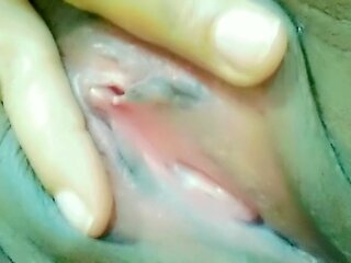 White Pussy Discharge