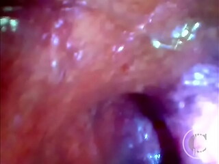 POV Extreme Deep Anal Exploration! Fast visible Heartbeat