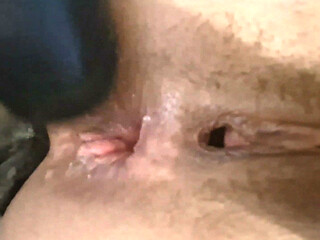 Dilation