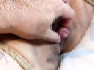 I Aspirate M Woman Clitoris and Am Fixed with Rubber
