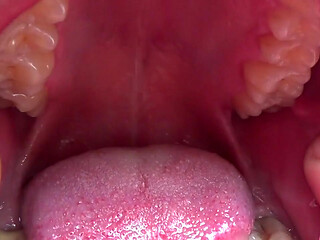 Kate open her mouth wide for you