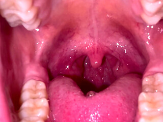 Mouth Tour No Makeup Teeth Tongue Uvula Tonsils Check