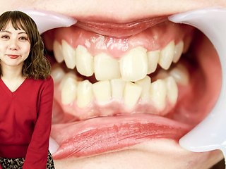 Inside Rumi's Mouth: Explore Her Dental Care Secrets!