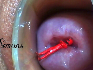 This Is What My Cervix Looks Like After a Year Without Seeing It.