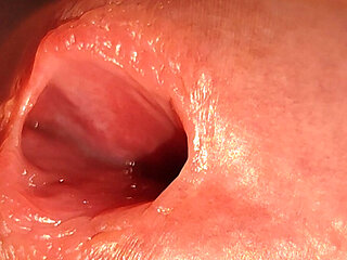 How to Widen a Glans Hole to the Extreme.