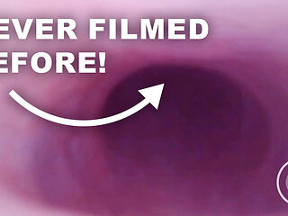 FISRT EVER POV COMSHOT FROM INSIDE THE PROSTATE
