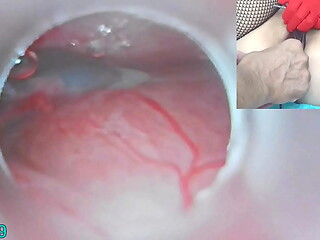 Japanese Insemination with Cum into Uterus and Endoscope Camera by Cervix to watch inside womb Uncensored