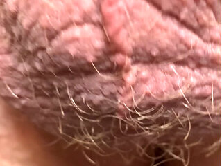 Uncircumcised in the tub at Uncutlounge