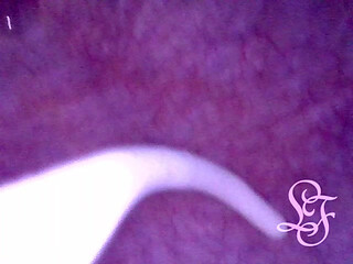 Can I fit the minicam AND a catheter inside my pee hole at the same time?