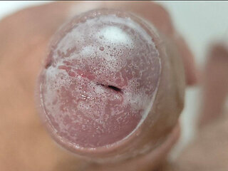 Extreme Burning Sensation Makes the Glans Foam with Arousal.