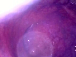 Look deep inside my ass!