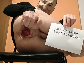 My ass after 200 extreme anal videos